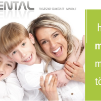 Apex Dental Bt. Fogászati szaküzlet