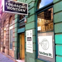 Radio Dental Fogászati Röntgen