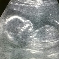 Dr. Jósa Elemér szülész-nőgyógyász Veszprém